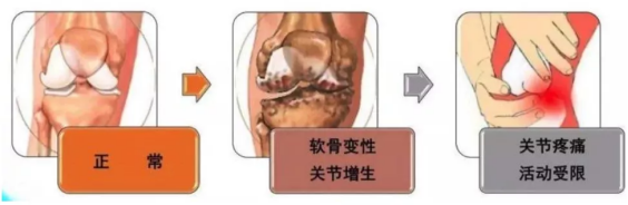 中誉人胶原蛋白肽：呵护关节健康,一起自在行动