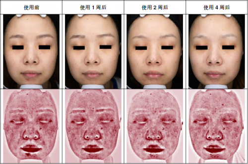 A.O.史密斯揭秘夏季皮肤出油干燥的真相