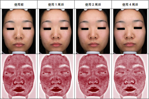 A.O.史密斯揭秘夏季皮肤出油干燥的真相