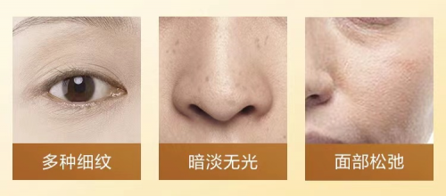 希美、科玛携手打造水梦露酵母系列，抗老滋养‘酵’醒年轻肌