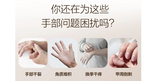 完美产品：你还在为这些手部问题烦恼？完美教你轻松呵护双手