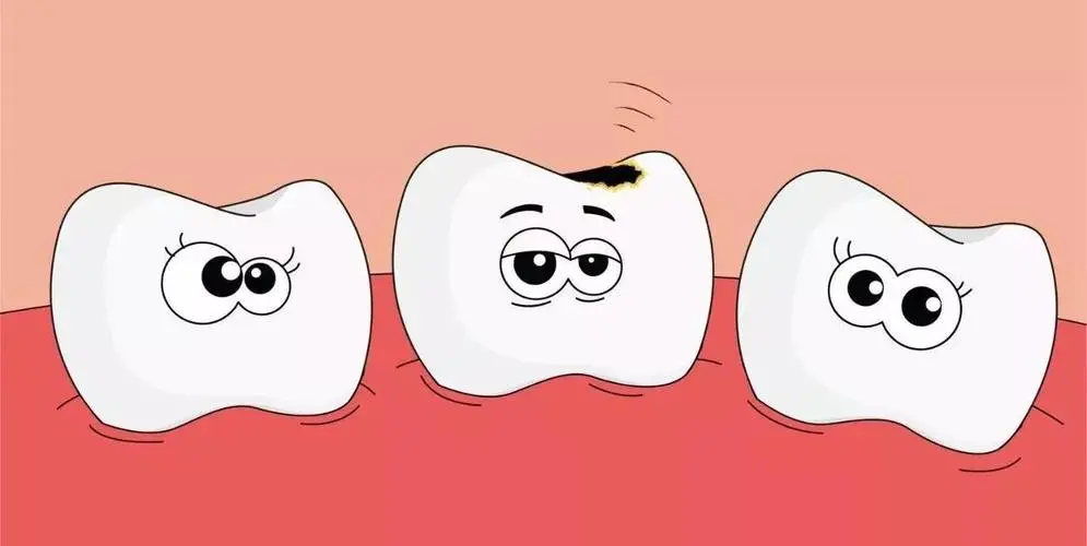 Biomice百奥美·干货科普·几岁开始做蛀牙预防？儿童蛀牙要补吗？
