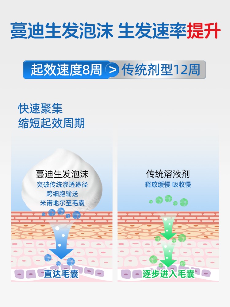 国内首个米诺地尔泡沫剂“蔓迪泡沫剂”上市 开启生发新纪元