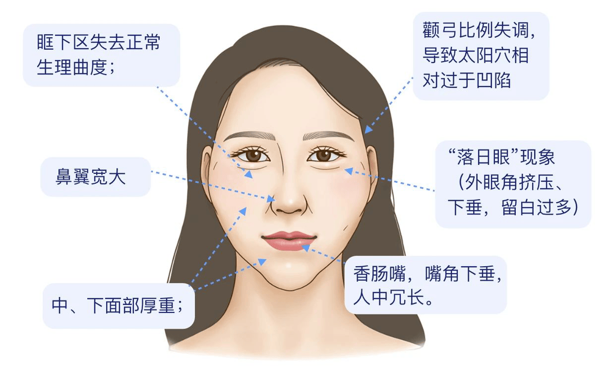 北京面部馒化修复中心接诊001号顾客，数字化科技赋能解决馒化难题