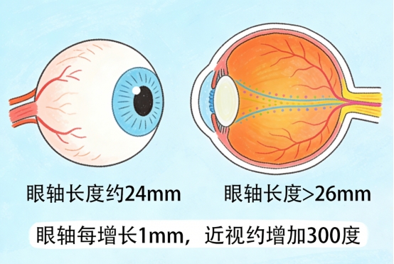 哈尔滨普瑞眼科提醒｜四类风险早辨别早干预